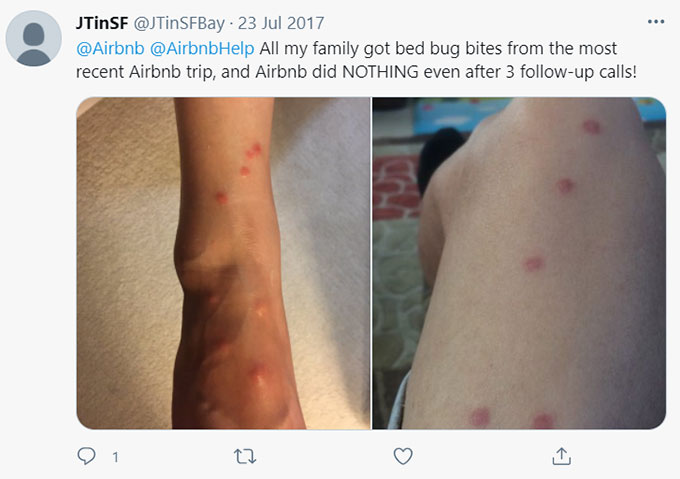 Airbnb Bugs, Bug Bites